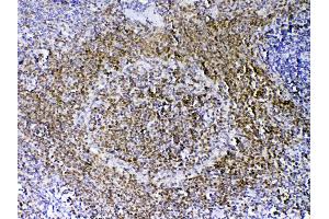 Immunohistochemistry (IHC) image for anti-Paired Box 5 (PAX5) (AA 217-282) antibody (ABIN5692907)