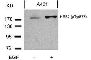 Image no. 3 for anti-Receptor tyrosine-protein kinase erbB-2 (ErbB2/Her2) (pTyr877) antibody (ABIN196748) (ErbB2/Her2 抗体  (pTyr877))