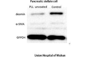 Western Blot (WB) analysis: Please contact us for more details. (Desmin 抗体  (C-Term))
