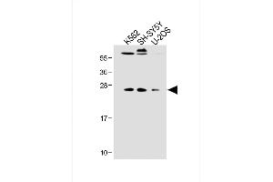 All lanes : Anti-N6T1 Antibody (N-term) at 1:2000 dilution Lane 1: K562 whole cell lysate Lane 2: SH-SY5Y whole cell lysate Lane 3: U-2OS whole cell lysate Lysates/proteins at 20 μg per lane. (N6AMT1 抗体  (N-Term))