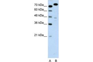Western Blotting (WB) image for anti-Minichromosome Maintenance Complex Component 3 (MCM3) antibody (ABIN2461390) (MCM3 抗体)