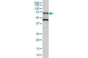 PGM2 monoclonal antibody (M05), clone 1A3 Western Blot analysis of PGM2 expression in Hela S3 NE . (Phosphoglucomutase 2 抗体  (AA 1-90))