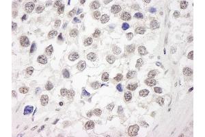 Immunohistochemistry (IHC) image for anti-Ubiquitin Interaction Motif Containing 1 (UIMC1) (C-Term) antibody (ABIN7449010) (UIMC1 抗体  (C-Term))