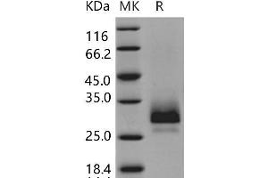 Tissue Factor Pathway Inhibitor 2 (TFPI2) protein (His tag)