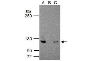 IP Image NFkB p100/p52 antibody immunoprecipitates NFkB p100/p52 protein in IP experiments. (NFKB2 抗体  (C-Term))