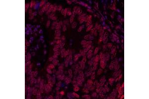 Immunofluorescence (IF) image for anti-Bromodomain Containing 3 (BRD3) (AA 676-726) antibody (ABIN7455203)