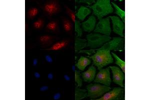 ABIN7094437 and ABIN7098485 staining  cells by IF/ICC. (STRA8 抗体  (Internal Region))
