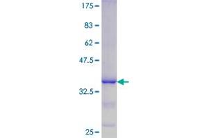 DUSP11 Protein (AA 221-330) (GST tag)