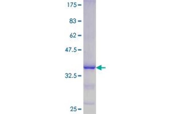 DUSP11 Protein (AA 221-330) (GST tag)