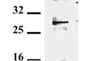 Detection of endogenous tollip in murine EL-4. (TOLLIP 抗体)