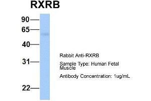 Host:  Rabbit  Target Name:  RXRB  Sample Type:  Human Fetal Muscle  Antibody Dilution:  1. (Retinoid X Receptor beta 抗体  (N-Term))