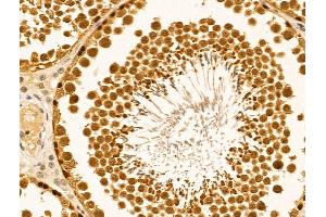 ABIN6261344 and ABIN6269035 at 1/100 staining Rat testis tissue by IHC-P.
