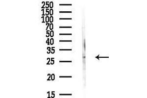 Western blot analysis of lysates from Hela cells(heat-shock,45 min treatment), using SYF2 Antibody at 1/1000 dilution.