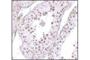 Immunohistochemistry of MED4 in human testis tissue with this product at 10 μg/ml. (MED4 抗体  (C-Term))