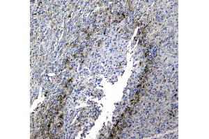 IHC analysis of Synaptotagmin 1 using anti-Synaptotagmin 1 antibody . (SYT1 抗体)