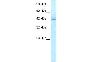 WB Suggested Anti-RGS20 Antibody Titration:  5. (RGS20 抗体  (N-Term))