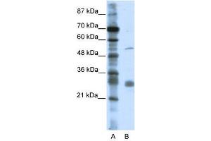 LRRC14 antibody used at 0. (LRRC14 抗体  (C-Term))