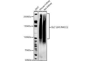 Western blot analysis of extracts of various cell lines, using SLC12/NKCC2 antibody (ABIN7270400) at 1:1000 dilution. (SLC12A1 抗体)