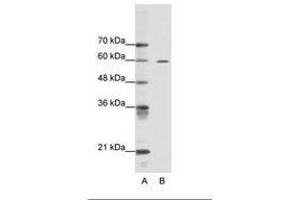 Image no. 1 for anti-AT Rich Interactive Domain 3A (BRIGHT-Like) (ARID3A) (AA 339-388) antibody (ABIN6736104) (ARID3A 抗体  (AA 339-388))
