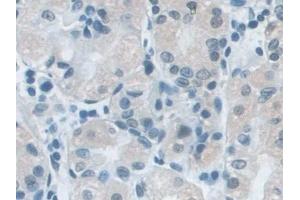 Immunohistochemistry (IHC) image for anti-Small Nuclear Ribonucleoprotein D1 Polypeptide 16kDa (SNRPD1) (AA 1-119) antibody (ABIN7442903)