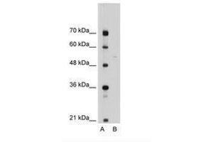 Image no. 2 for anti-Sep (O-phosphoserine) tRNA:Sec (Selenocysteine) tRNA Synthase (SEPSECS) (AA 61-110) antibody (ABIN6736318)