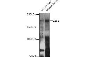 Western blot analysis of extracts of various cell lines, using ZEB2 antibody (ABIN6131480, ABIN6150424, ABIN6150425 and ABIN6221369) at 1:500 dilution. (ZEB2 抗体  (AA 1050-1214))