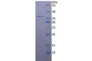 SDS-PAGE analysis of Human Nucleoporin 98 kDa Protein. (NUP98 蛋白)