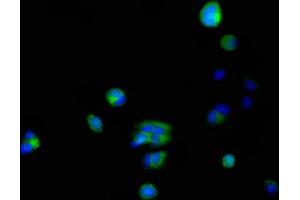 Immunofluorescent analysis of MCF-7 cells using ABIN7156155 at dilution of 1:100 and Alexa Fluor 488-congugated AffiniPure Goat Anti-Rabbit IgG(H+L) (FKBP6 抗体  (AA 101-327))