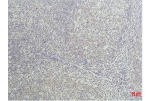 Immunohistochemistry (IHC) analysis of paraffin-embedded Human Tonsil Tissue using TNF a Mouse Monoclonal Antibody diluted at 1:50. (TNF alpha 抗体)