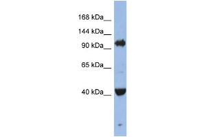WB Suggested Anti-EIF2C4 Antibody Titration: 0. (AGO4 抗体  (Middle Region))