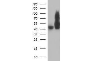 Image no. 1 for anti-Tubulin, beta 2B (TUBB2B) antibody (ABIN1501573) (TUBB2B 抗体)