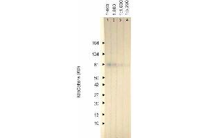 Western Blotting (WB) image for anti-Herpes Simplex Virus Type 1, Glycoprotein C (HSV1 gC) antibody (ABIN265558)