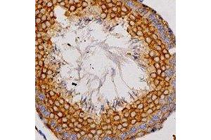 Immunohistochemical analysis of Adenosine A2a Receptor staining in human testis formalin fixed paraffin embedded tissue section. (Adenosine A2a Receptor 抗体  (C-Term))