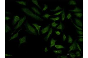Immunofluorescence of monoclonal antibody to COX6C on HeLa cell. (COX6C 抗体  (AA 1-75))