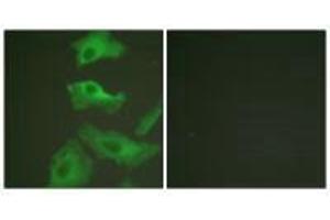 Immunofluorescence analysis of HeLa cells, treated with TNF-a (20nM, 15 mins), using HSP90B (Ab-254) antibody. (HSP9AB1 (Ser254) 抗体)