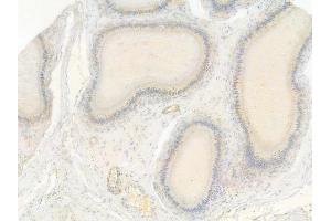 ABIN7093391 and ABIN7097412 at 1/100 staining human testicular cancer by IHC-P. (IRF7 抗体)