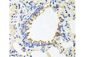 Immunohistochemistry of paraffin-embedded Rat lung using CALU Polyclonal Antibody at dilution of 1:100 (40x lens). (CALU 抗体)