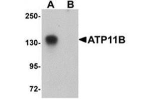 Western Blotting (WB) image for anti-ATPase, Class VI, Type 11B (ATP11B) (N-Term) antibody (ABIN783661)
