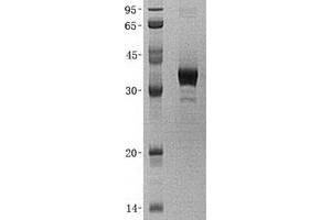 Western Blotting (WB) image for UDP-Galactose-4-Epimerase (GALE) (Transcript Variant 1) protein (His tag) (ABIN2721599)