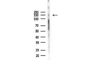 anti-Insulin Receptor-Related Receptor (INSRR) (N-Term) antibody