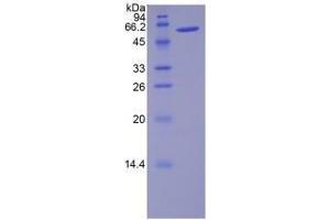 Figure. (NOG Protein (AA 28-144) (MBP tag,His tag))