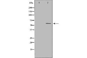 Western blot analysis of extracts of Jurkat using CASP10 Antibody. (Caspase 10 抗体)