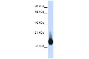 Claudin 5 antibody used at 1 ug/ml to detect target protein. (Claudin 5 抗体)