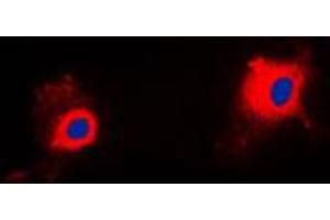 Immunofluorescent analysis of PIG11 staining in HuvEc cells. (TP53I11 抗体  (Center))