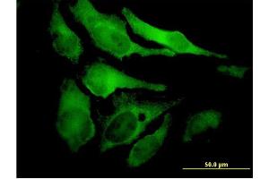 Immunofluorescence of monoclonal antibody to EYA2 on HeLa cell.