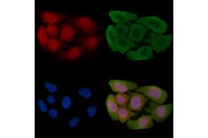 ABIN6256291 and ABIN6267489 staining Hela cells(30 min of UV treatment) by IF/ICC.