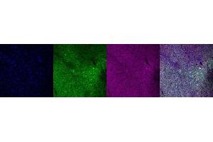 Immunohistochemistry (IHC) image for anti-Calbindin (CALB1) antibody (ABIN7456075) (CALB1 抗体)