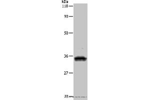 Western blot analysis of 293T cell, using UPK3B Polyclonal Antibody at dilution of 1:1000 (Uroplakin 3B 抗体)