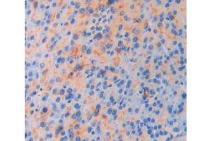 IHC-P analysis of pancreas tissue, with DAB staining. (IL18R1 抗体  (AA 182-336))