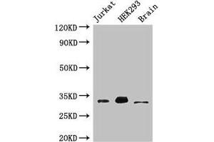 Western Blot Positive WB detected in: Jurkat whole cell lysate, HEK293 whole cell lysate, Mouse brain tissue All lanes: MBD3 antibody at 3 μg/mL Secondary Goat polyclonal to rabbit IgG at 1/50000 dilution Predicted band size: 33, 30 kDa Observed band size: 33 kDa (MBD3 抗体  (AA 79-209))